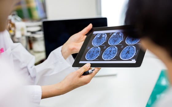 Electronic image of an MRI scan on head